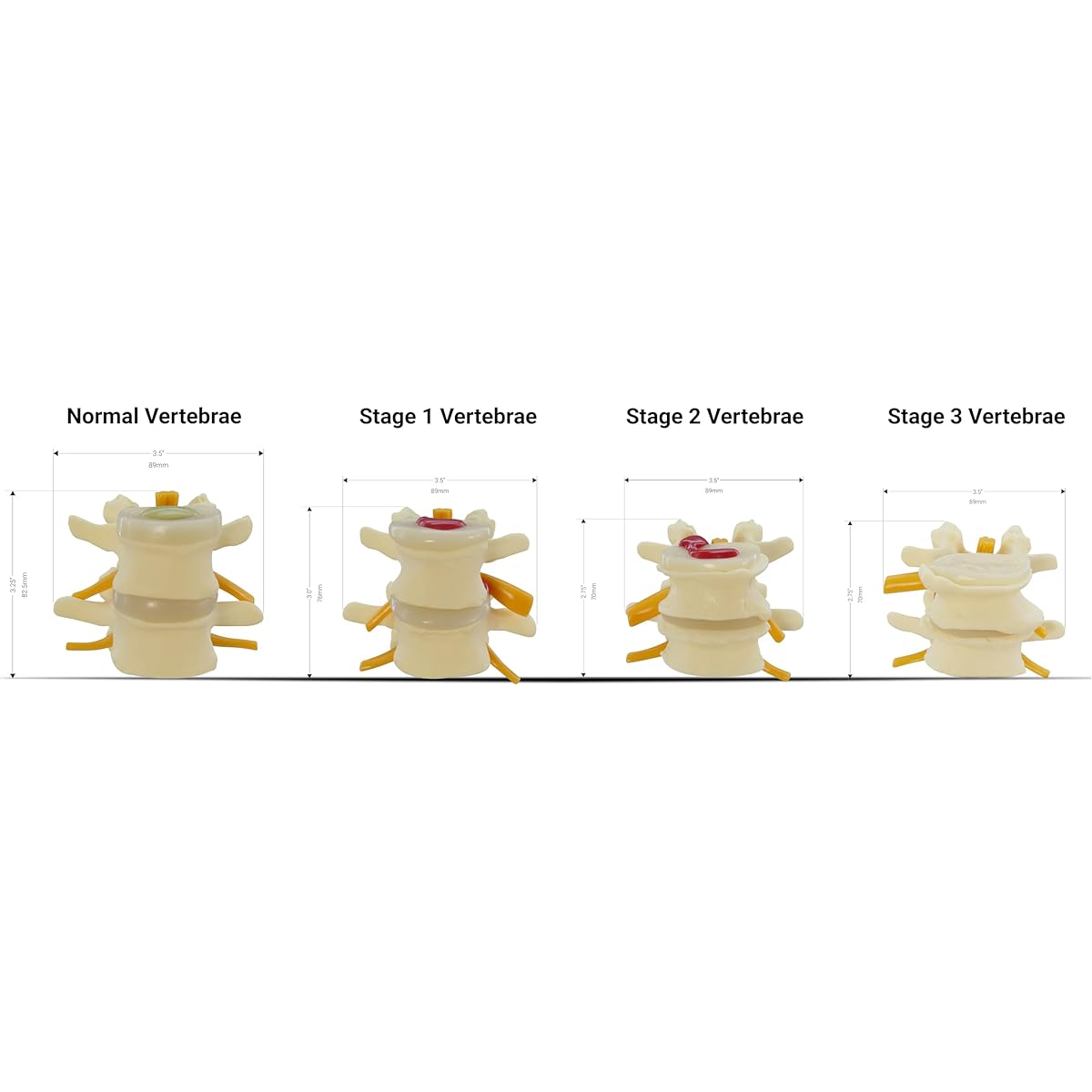GPI Anatomy - 4 Level Spine Model Spine Model for Human Anatomy and Physiology Education Anatomy Model for Doctor's Office or Classroom Medical Learning Supplies