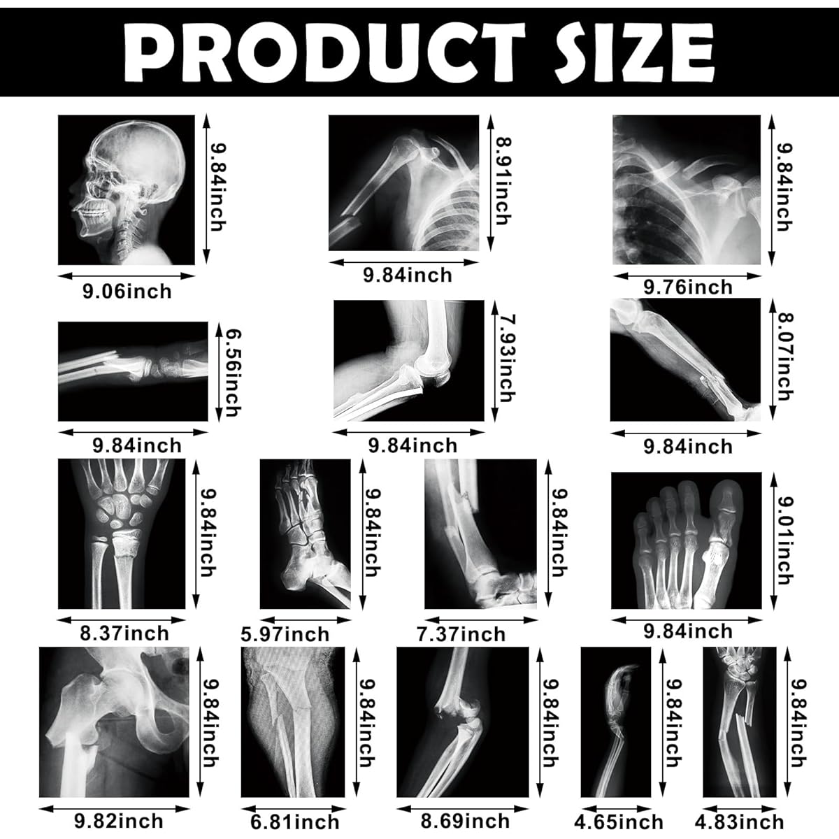 Sayglossy 15pcs Broken Bones X-Ray Set, Human X-Ray Black and White Skeleton Pretend X-Ray for Kids