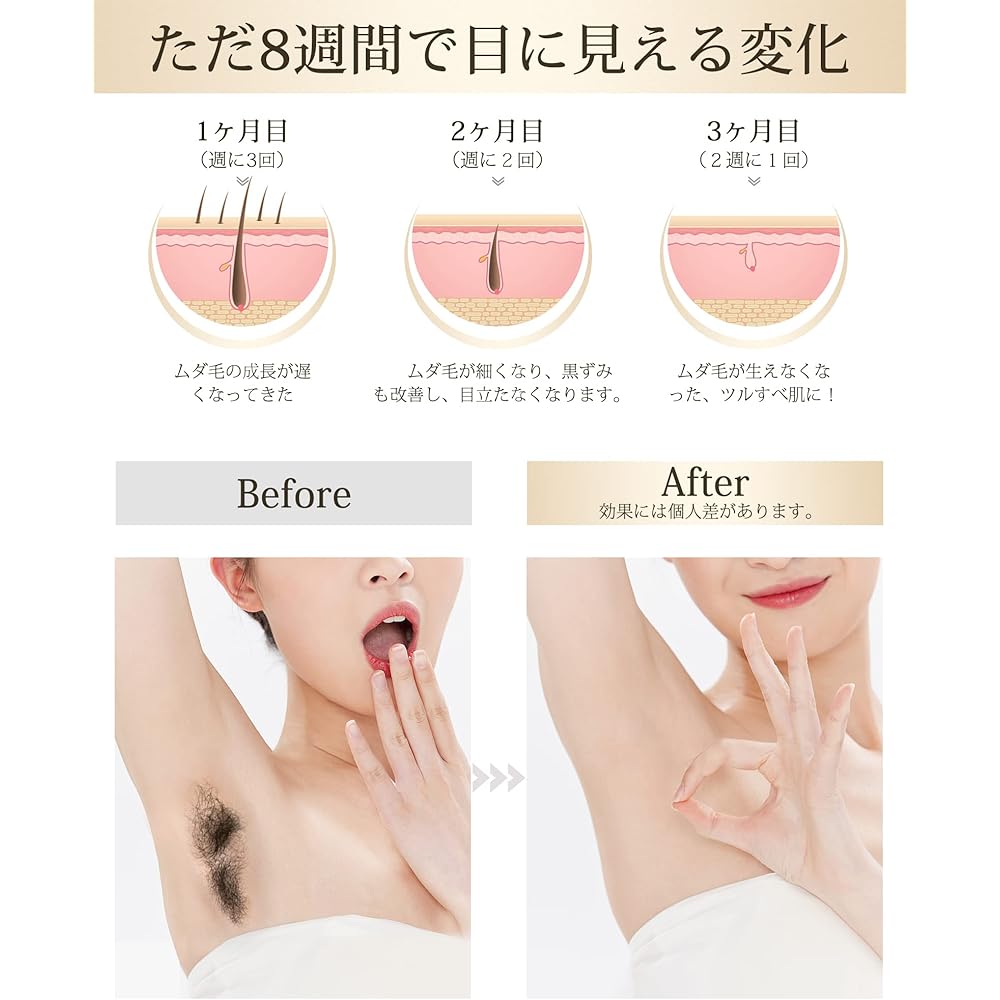 Uamector Hair Removal Device, Low Temperature Sapphire Cooling, Fast, Painless, Lightweight, Compatible with vio, Datsumouki Hair Removal Device, 990,000 Rounds, 5 Level Adjustment, Automatic Irradiation, Home Use Hair Removal Device, Unisex