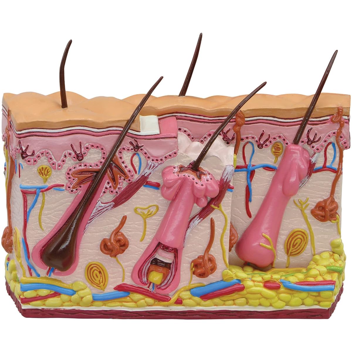 GPI Anatomicals - Skin Acne Model Cross Section View Skin Covering Normal and Common Acne Human Anatomy Physiology Education Anatomical Model Medical Learning Resources