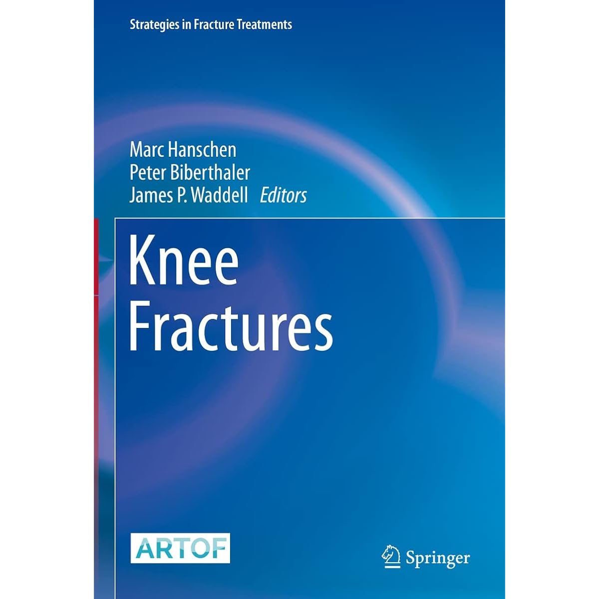 Knee Fractures (Strategies in Fracture Treatments) (English Edition) Kindle版