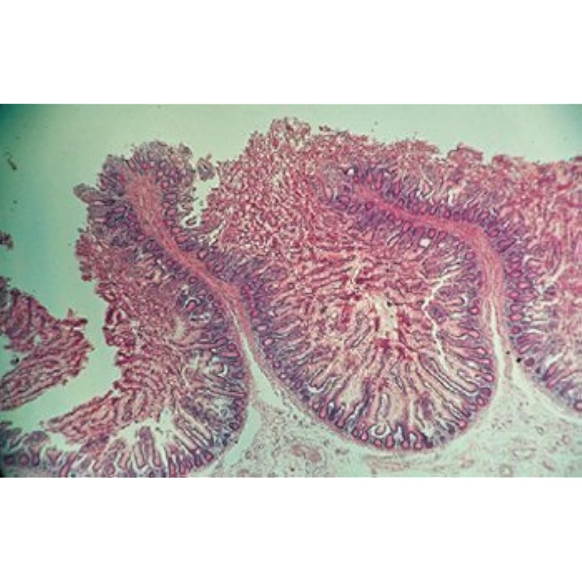 Kenis Anatomical Tissue Preparations 20 Types, 1 of Each (1-157-045) Observe the Structure of Tissues Under a Microscope!