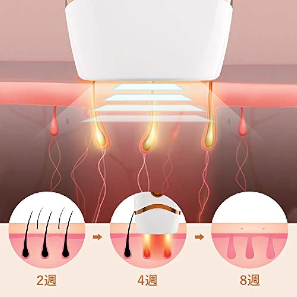 Hair removal device, 990,000 times irradiation, permanent hair removal, IPL light hair removal device, light beauty device, 5 steps, home use hair removal device, unwanted hair care, unisex, full body hair removal possible, Japanese instructions included