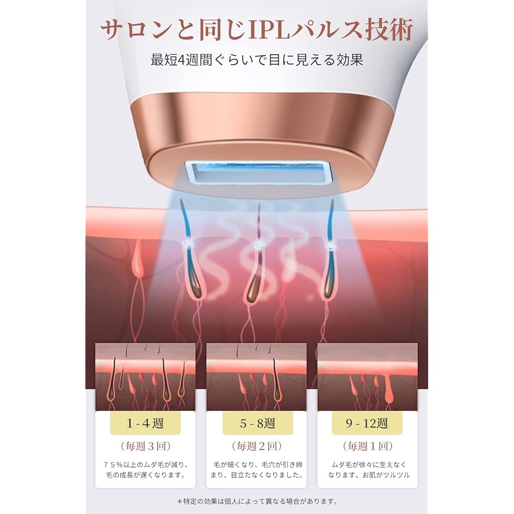 Epilator, Unlimited Number of Irradiation, Home Epilator, Laser Epilator, Body, Face, Beard, Arm, Vio Compatible, IPL Pulse Technology, HIPL Light Epilator, Painless Care, Smooth Skin Beautiful, LCD