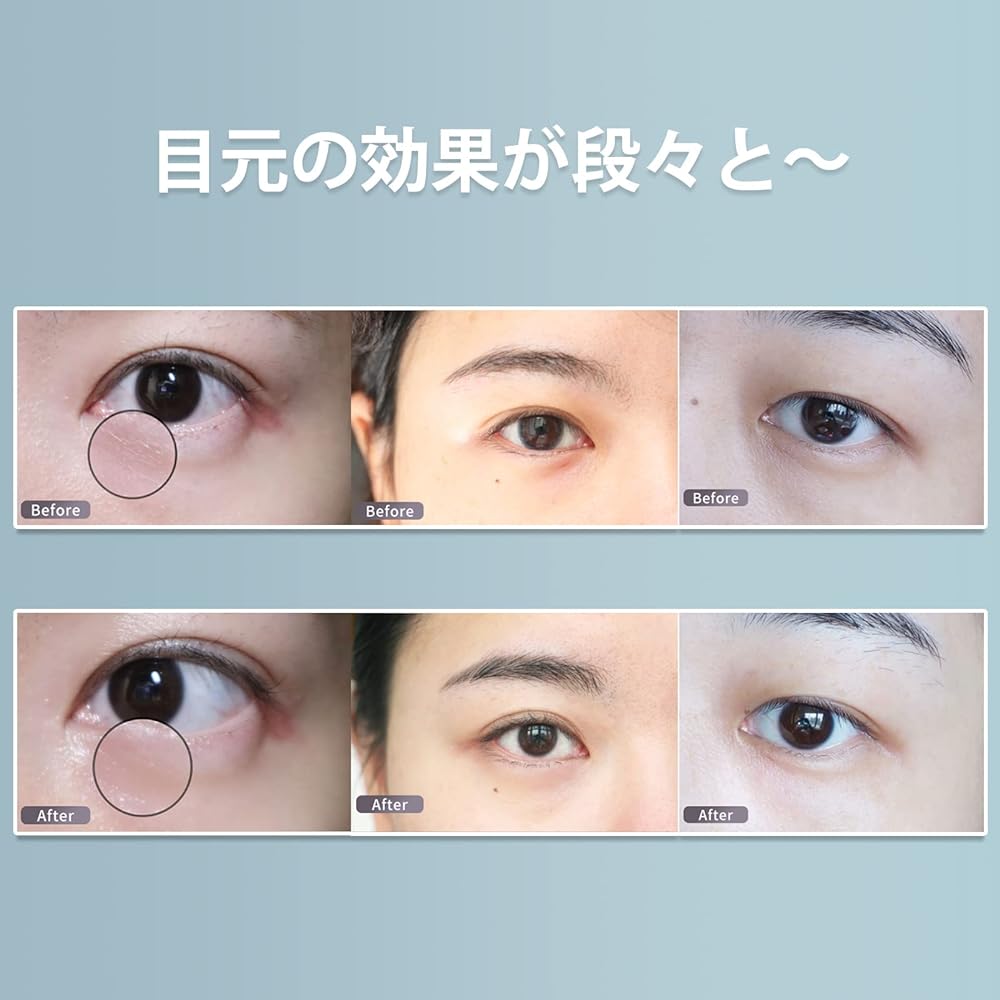 Eye facial device EMS Eye facial device Eye care Intensive eye care Eye beauty iontophoresis Ultrasonic facial device Wearable EMS mask Silicone mask Eye mask Heat care 3 types of modes 9 levels Ultrasonic vibration function Convenient goods USB recharge