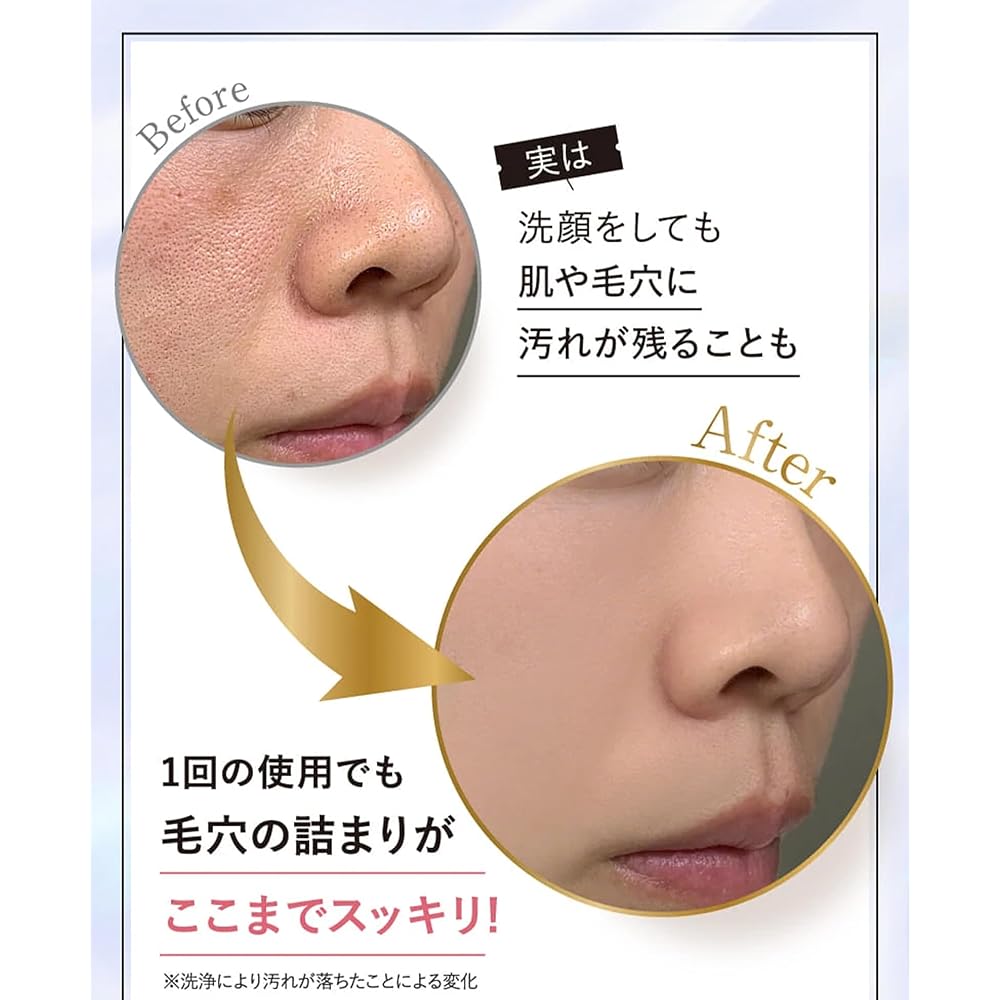 MELLIFE Total Facial Plus [Facial device, lift care, ion cleansing, water peeling, ultrasonic skin care, LED light beauty, electric pulse, radio waves, pores, dullness, smile lines, moisturizing]