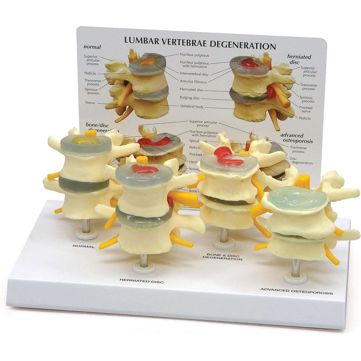 GPI Anatomy - 4 Level Spine Model Spine Model for Human Anatomy and Physiology Education Anatomy Model for Doctor's Office or Classroom Medical Learning Supplies