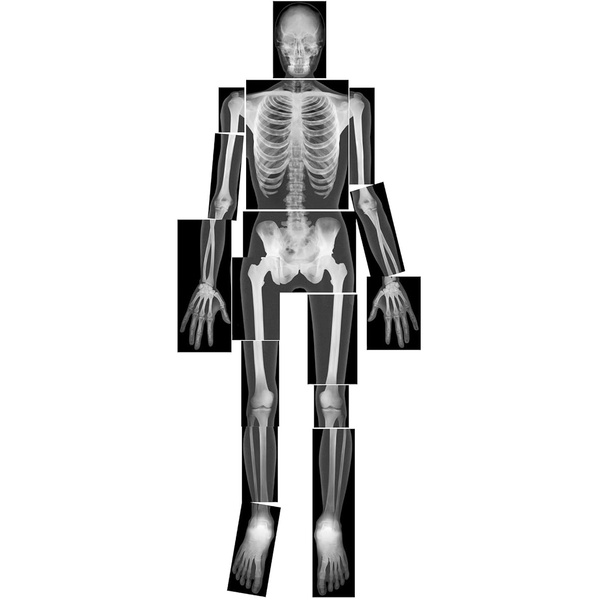 [Roylco]Roylco True To Life Human XRays R-5911 [Parallel Import]