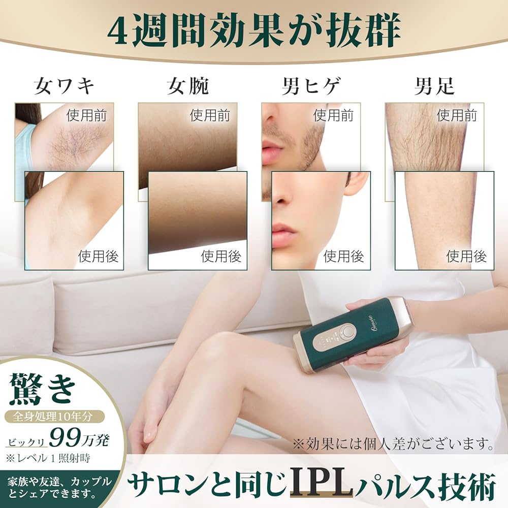 [Salon grade IPL light hair removal device] Omuse hair removal device compatible with vio, compatible with beard, face, armpits, back, bikini line, beard, face, men, women, home use, self hair removal, light beauty device, comes with razor, goggles, and