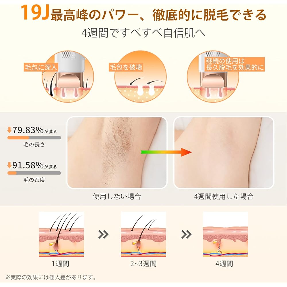 Epilator, Men's, Women's, Vio Compatible, 2024 Latest Salon Grade IPL Epilator, Painless Hair Removal, Home Epilator, Large Screen Touch Panel, 19.3J, 990,000 Rounds Adjustable, 9 Levels Adjustable,